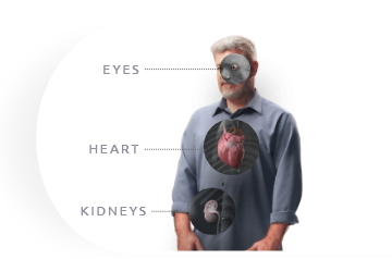 An image of a man overlaid with anatomic illustrations depicting complications from gout in the eyes, heart, and kidneys