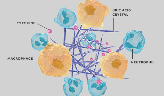 aggNET URIC ACID CRYSTAL NEUTROPHIL MACROPHAGE CYTOKINE